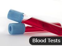 Blood tests