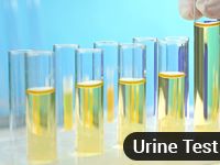 Urine test