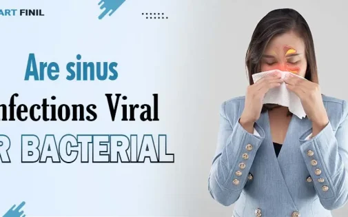 Are sinus infections viral or bacterial 