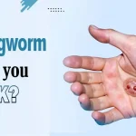 Can ringworms make you sick?
