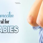 Ivermectin oral for scabies