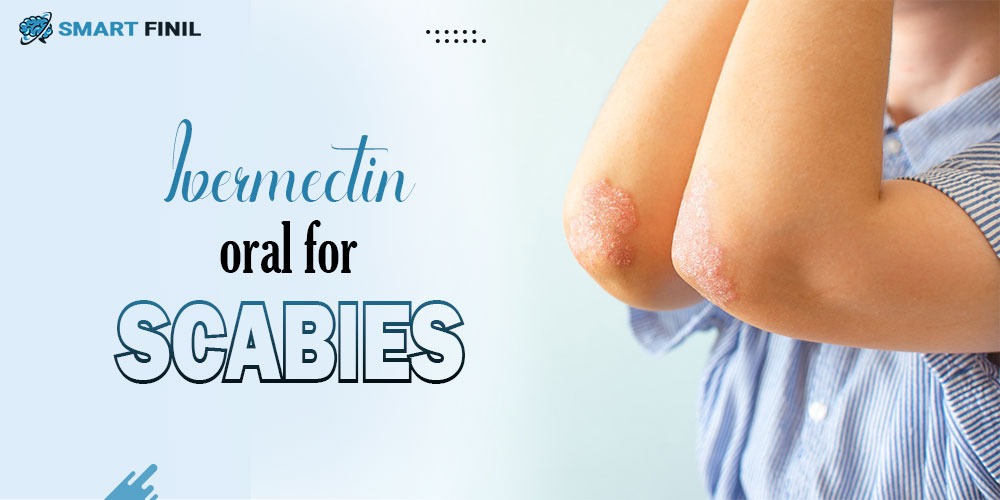 Ivermectin oral for scabies